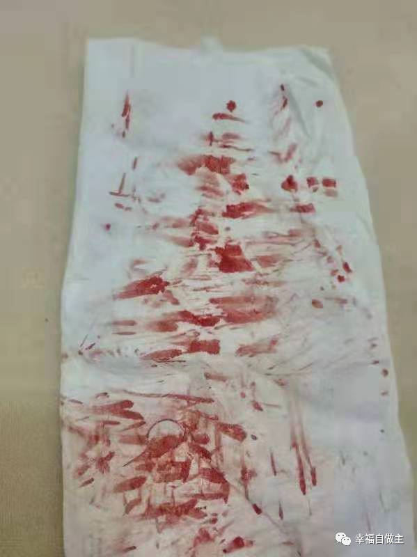 过敏性皮肤炎案例