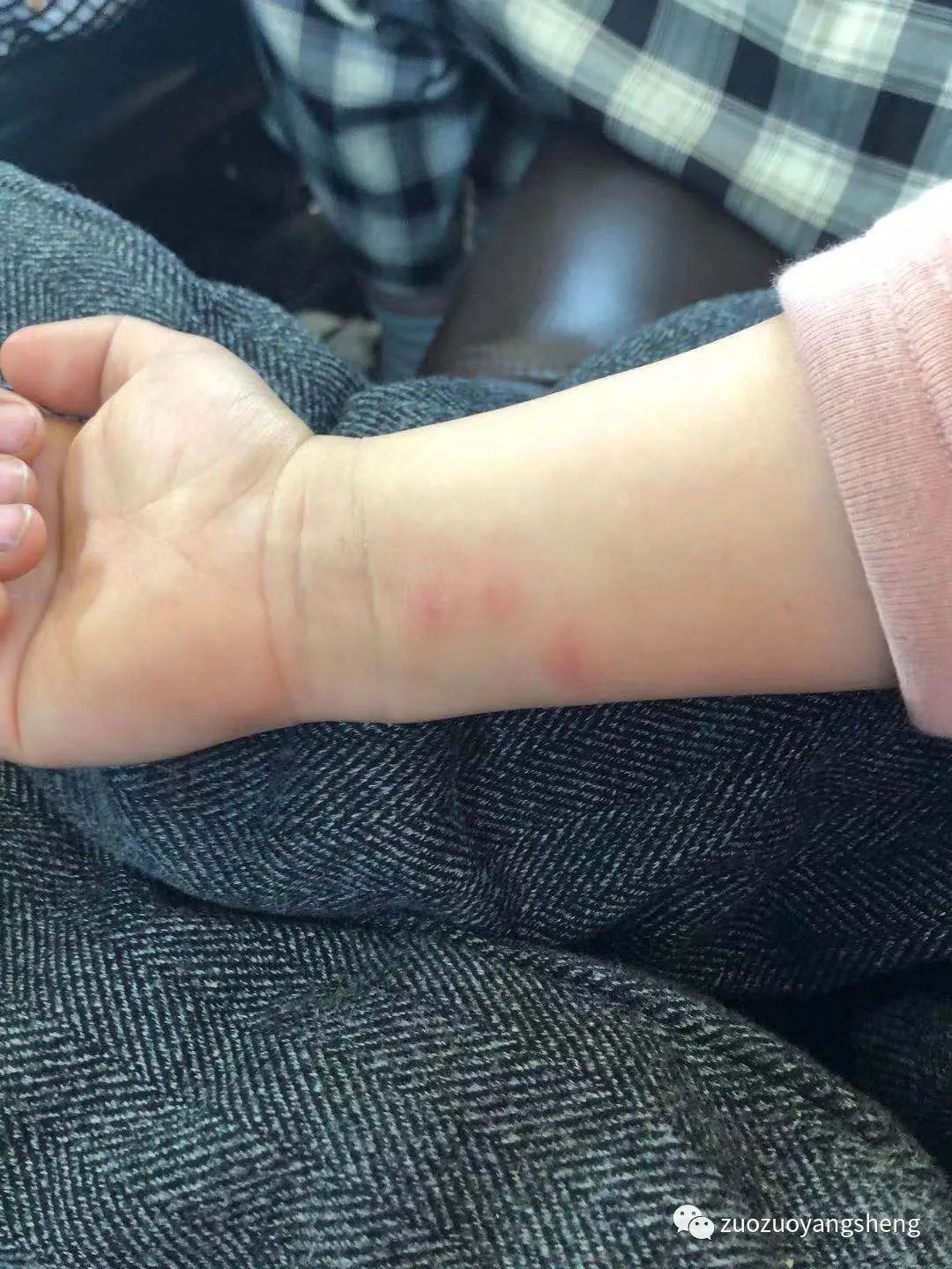 微问答229期:小孩长了一身的红疙瘩原始点如何调理? 微问答229期:小孩长了一身的红疙瘩原始点如何调理?