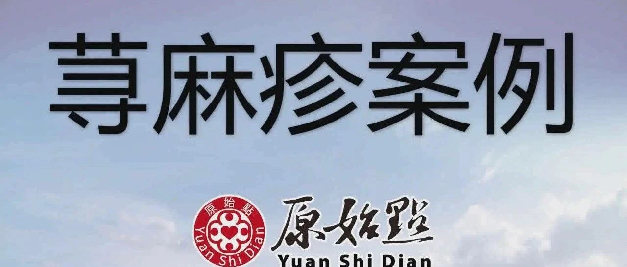 91岁家母荨麻疹 及晕倒案例2020年10月-原始点全球同学网