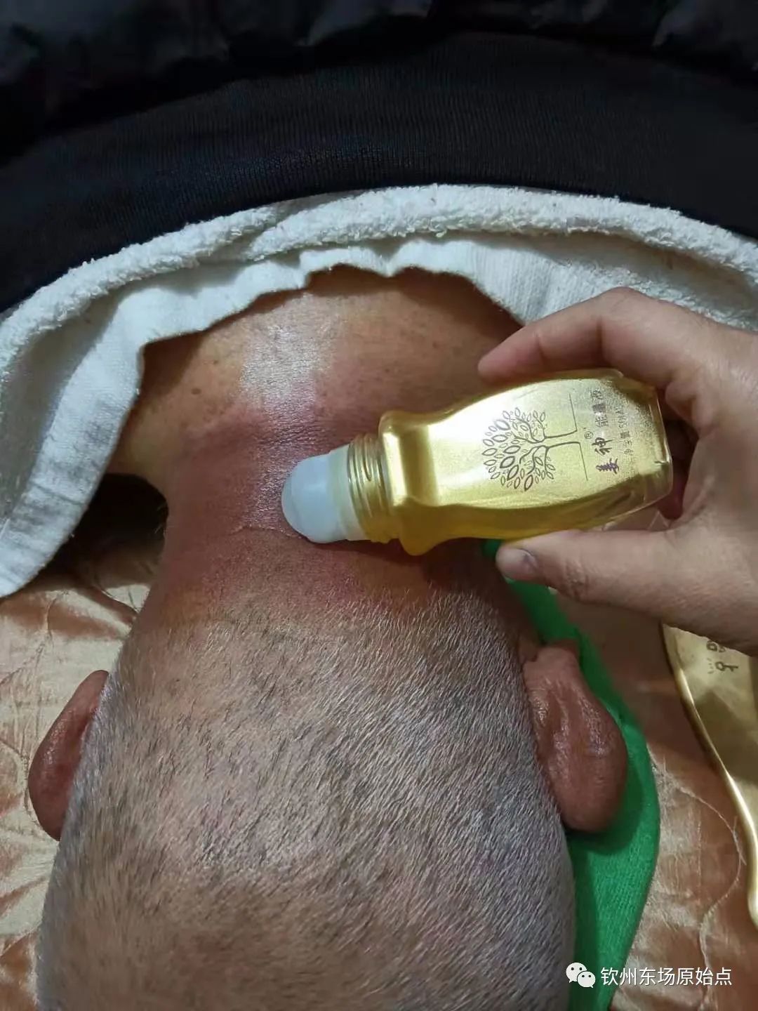 咳嗽,肩周炎案例 咳嗽,肩周炎案例