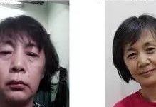 肺炎吐血案例-原始点全球同学网