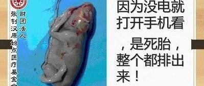 怀孕19周胎死腹中案例-原始点全球同学网