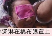 参汤洗眼改善儿童视力案例-原始点全球同学网
