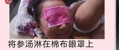 参汤洗眼改善儿童视力案例-原始点全球同学网