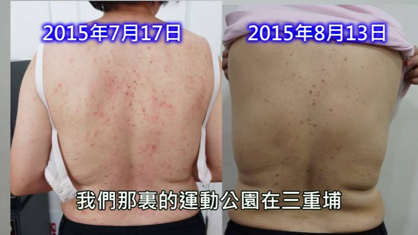 营养食品中毒案例