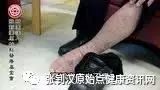 脚皮肤异常案例(温哥华)-原始点全球同学网
