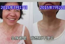 营养食品中毒案例-原始点全球同学网