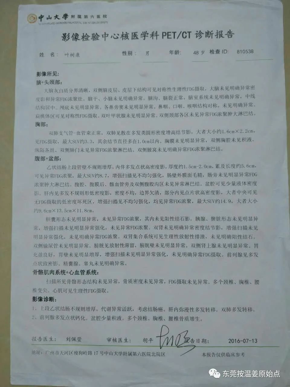 结肠癌、肝转移、肺转移 结肠癌、肝转移、肺转移