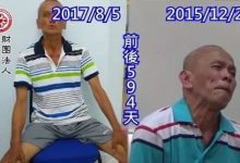 梅杰综合症案例--2017.10最新案例-原始点全球同学网