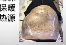 腹水案例-原始点全球同学网