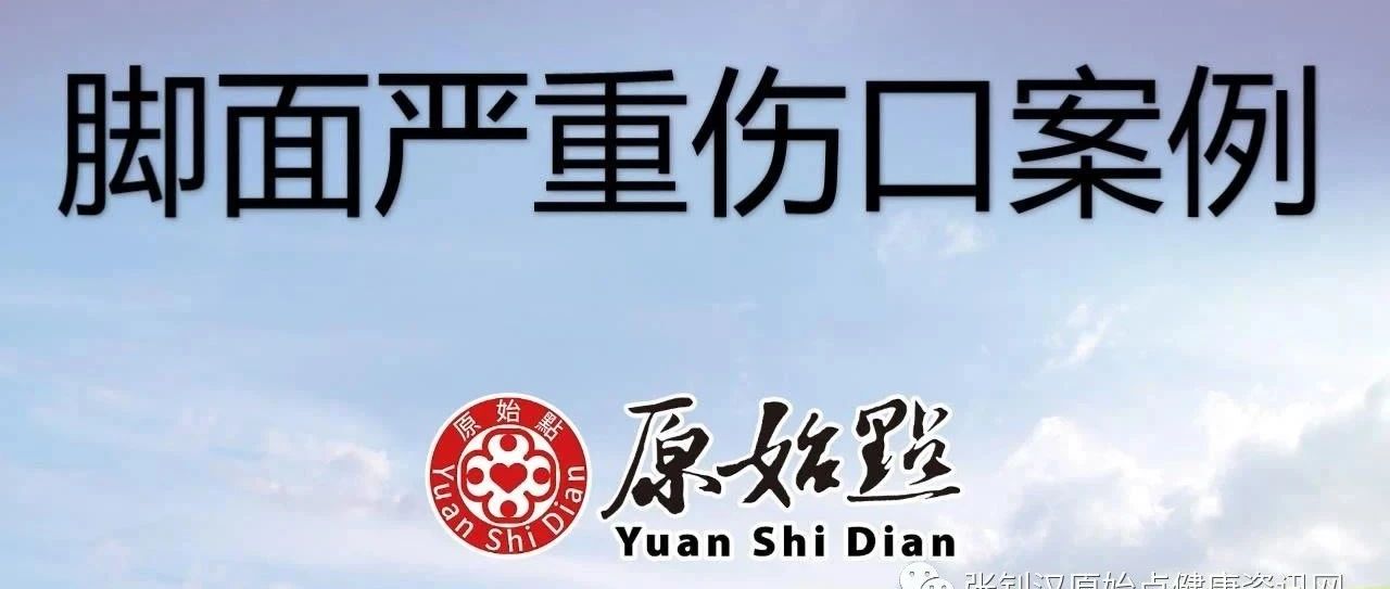 80岁的老人脚面严重伤口案例-原始点全球同学网