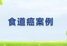 食道癌案例(新疆)-原始点全球同学网