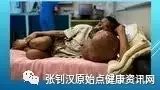 肿瘤头部两倍大案例-原始点全球同学网