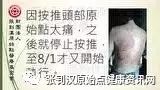 异位性皮服炎案例(陈小姐)-原始点全球同学网