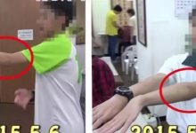 手骨裂21天恢复案例（简体版）-原始点全球同学网