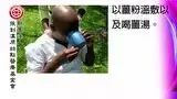 头部溃烂案例(辛巴威)-原始点全球同学网