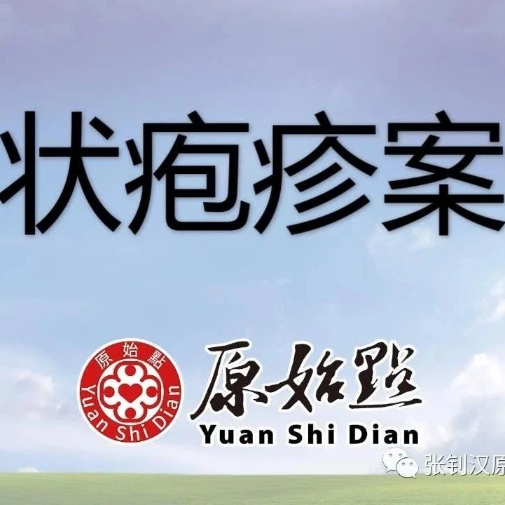 李先生2021年带状疱疹案例 日期：2021/3/13-原始点全球同学网