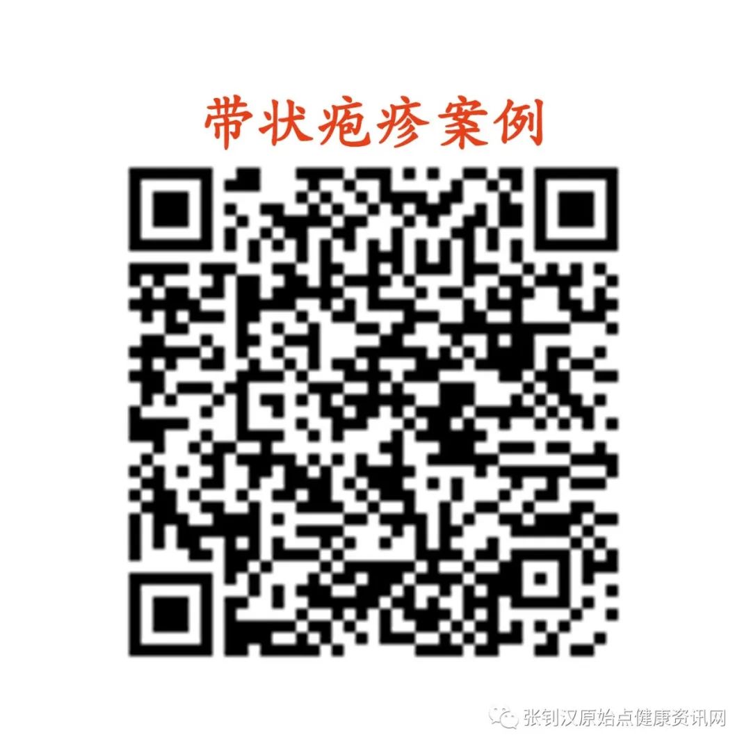 带状疱疹案例 带状疱疹案例