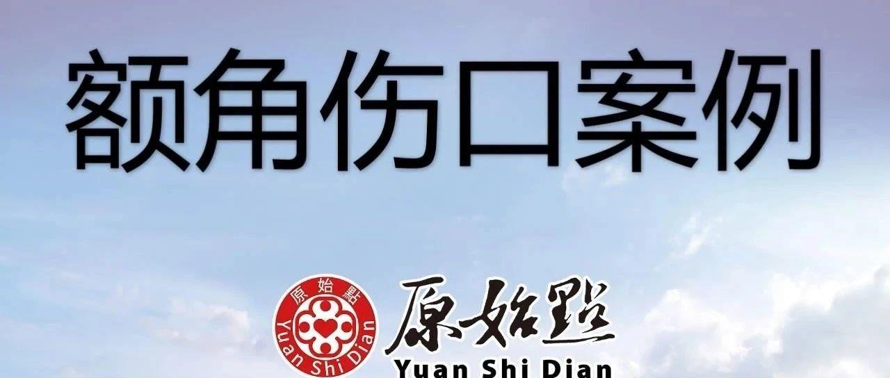 额角伤口案例-原始点全球同学网