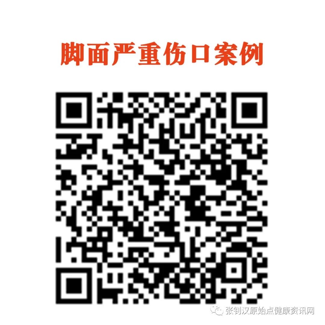 脚面严重伤口案例 脚面严重伤口案例