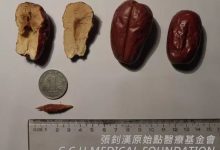 枣核划伤食道,难以吞咽案例-原始点全球同学网