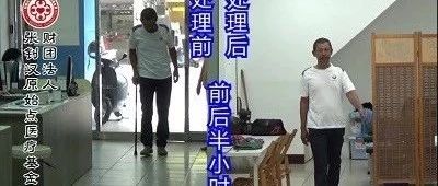 小腿麻痛案例-原始点全球同学网