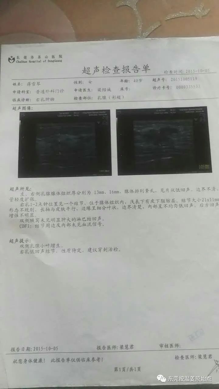 原始点调理乳腺癌