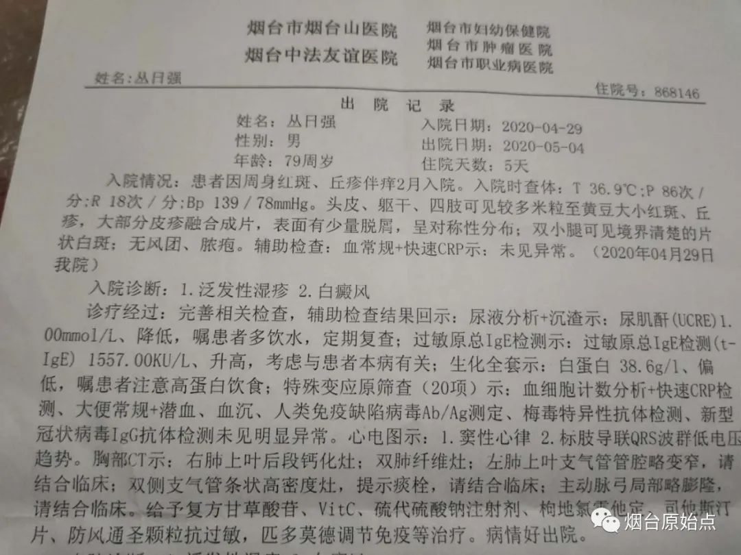 泛发性湿疹案例