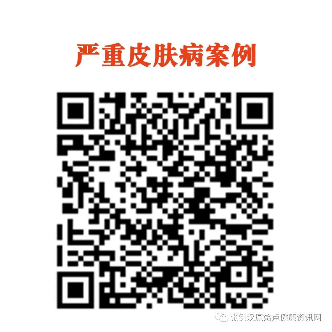 严重皮肤病案例 严重皮肤病案例