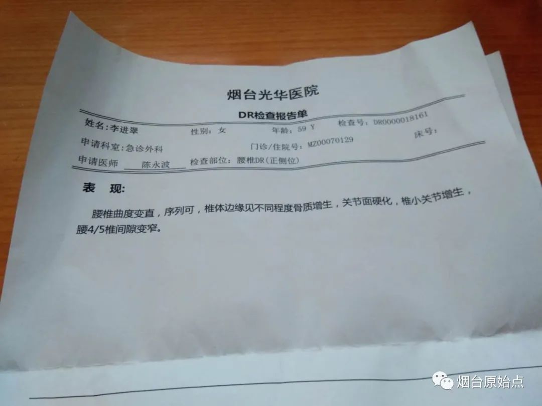 腰椎间盘突出增生案例 腰椎间盘突出增生案例