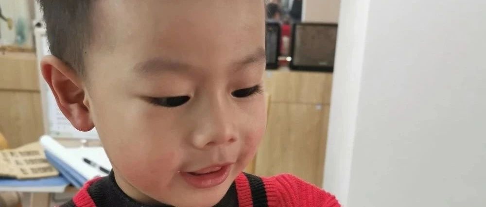 案例分享：原始点调理小孩湿疹的案例-原始点全球同学网