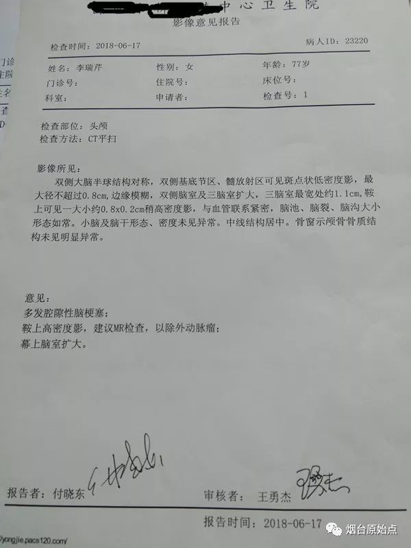77岁老人脑梗案例