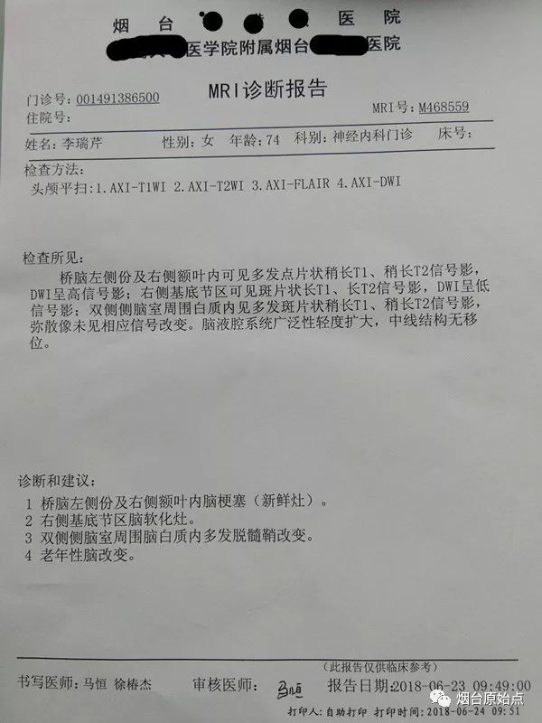 77岁老人脑梗案例 77岁老人脑梗案例
