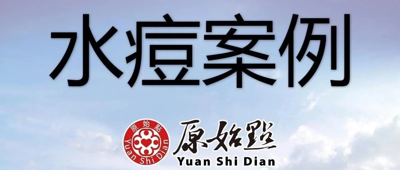 自身得水痘自我调理案例-厦门黄学员2021.6.20补充-原始点全球同学网