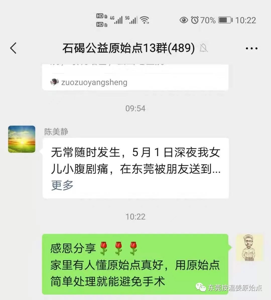 急性阑尾炎
