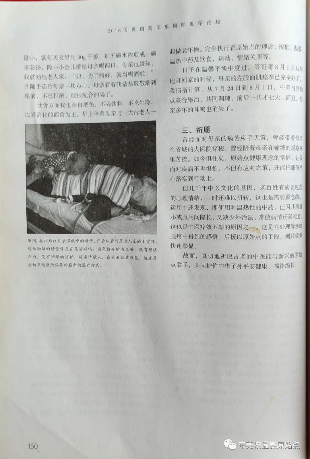 中医与原始点联手处理面肌痉挛 中医与原始点联手处理面肌痉挛