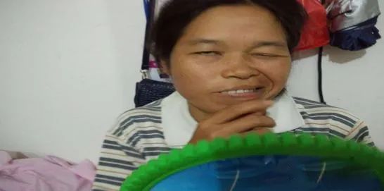 原始点案例:面瘫案例合集 原始点案例:面瘫案例合集