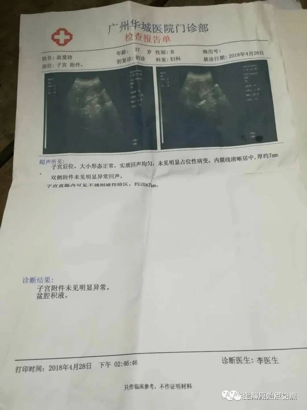 妇科病案例：阴道炎，宫颈炎，盘腔积液