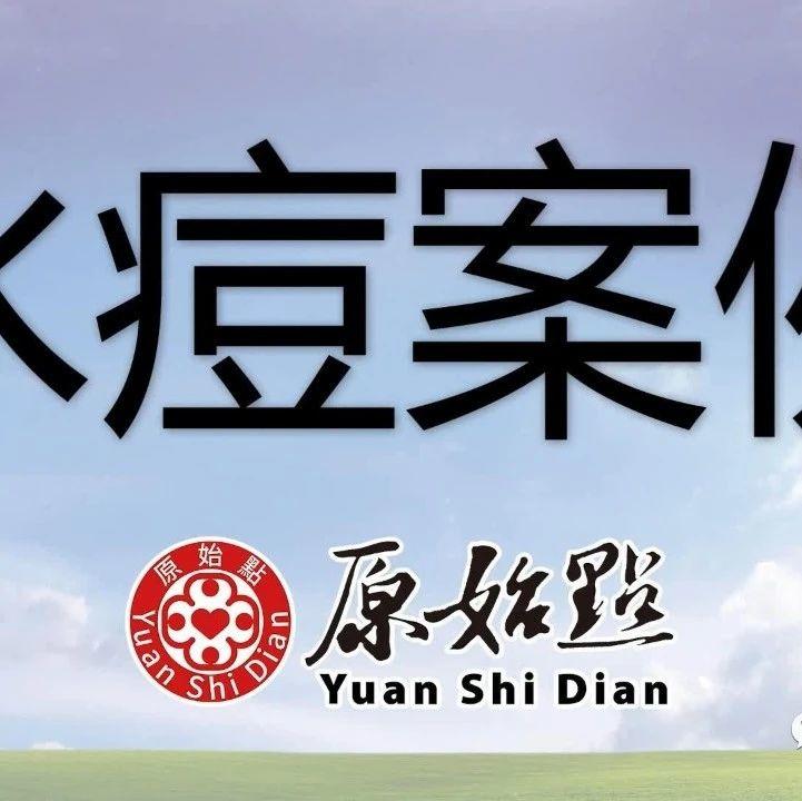 水痘案例（佛山）2020年9月-原始点全球同学网