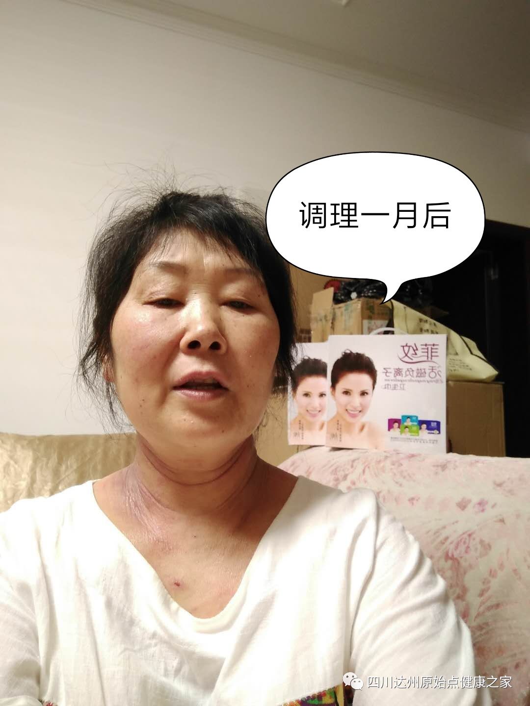 【原始点案例】原始点调理神经性皮炎