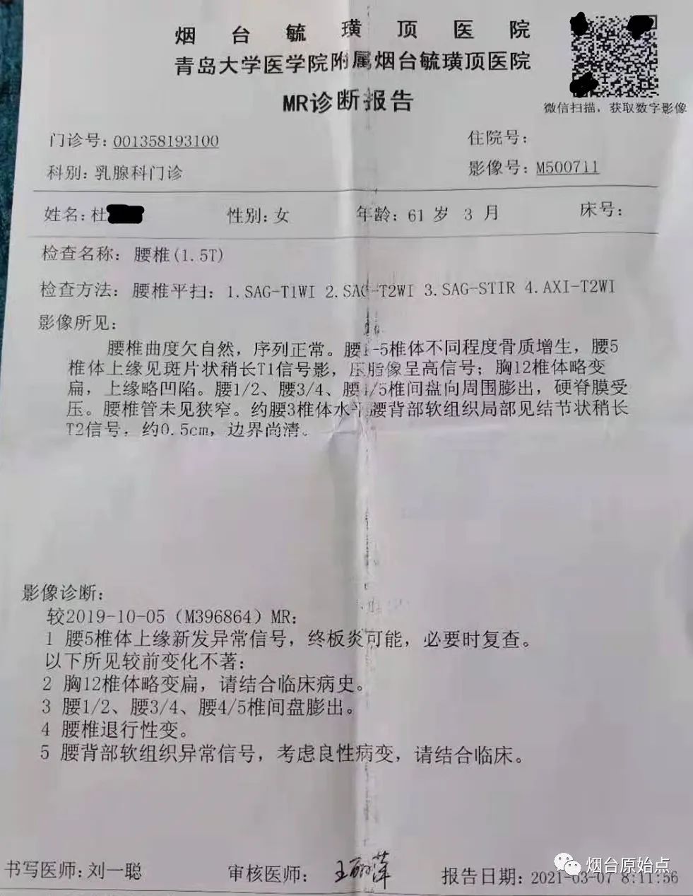 腰椎退行性变腰疼、腿疼案例 腰椎退行性变腰疼、腿疼案例