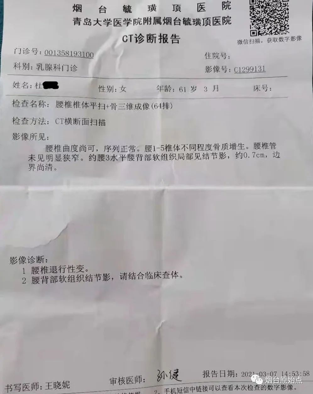 腰椎退行性变腰疼、腿疼案例 腰椎退行性变腰疼、腿疼案例