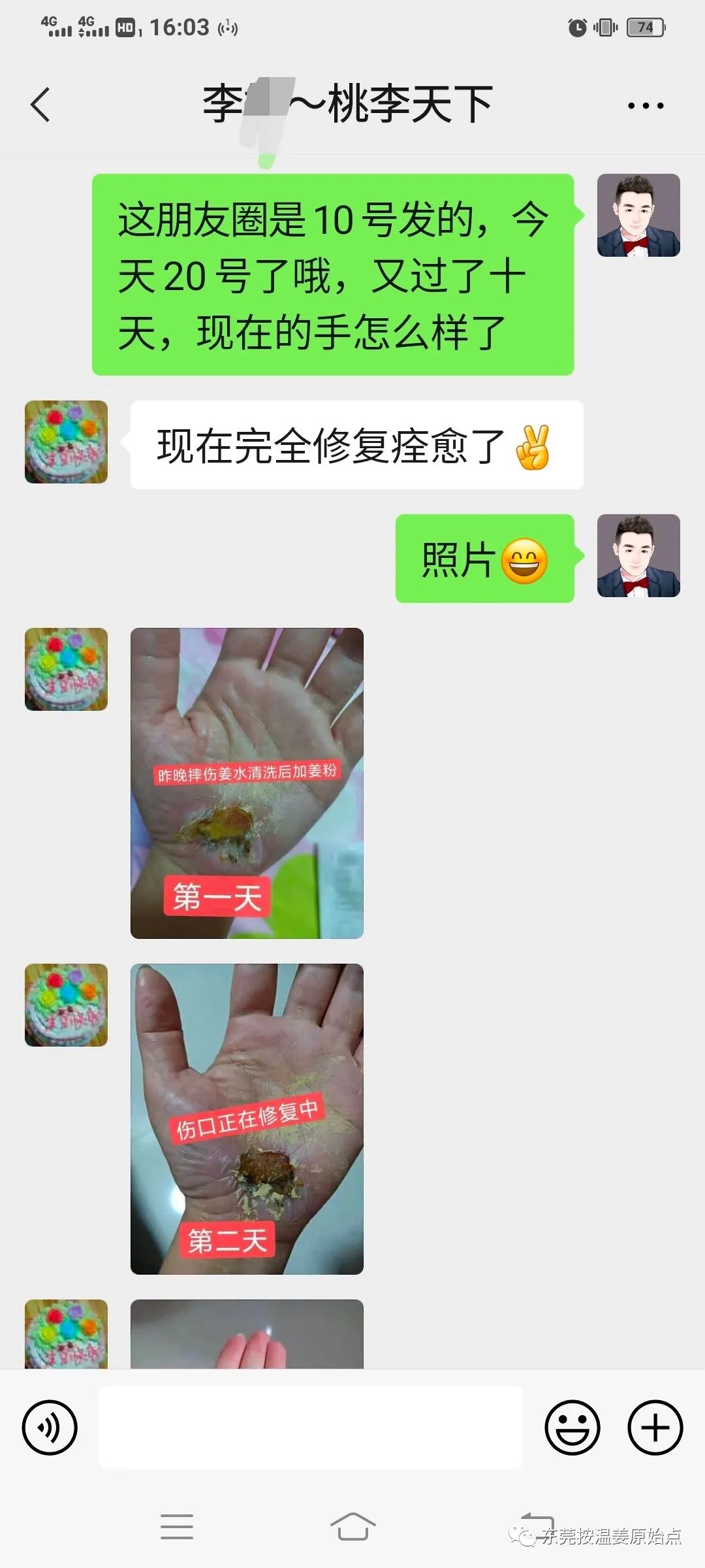 《被电瓶车撞跌倒案例》跟进 《被电瓶车撞跌倒案例》跟进