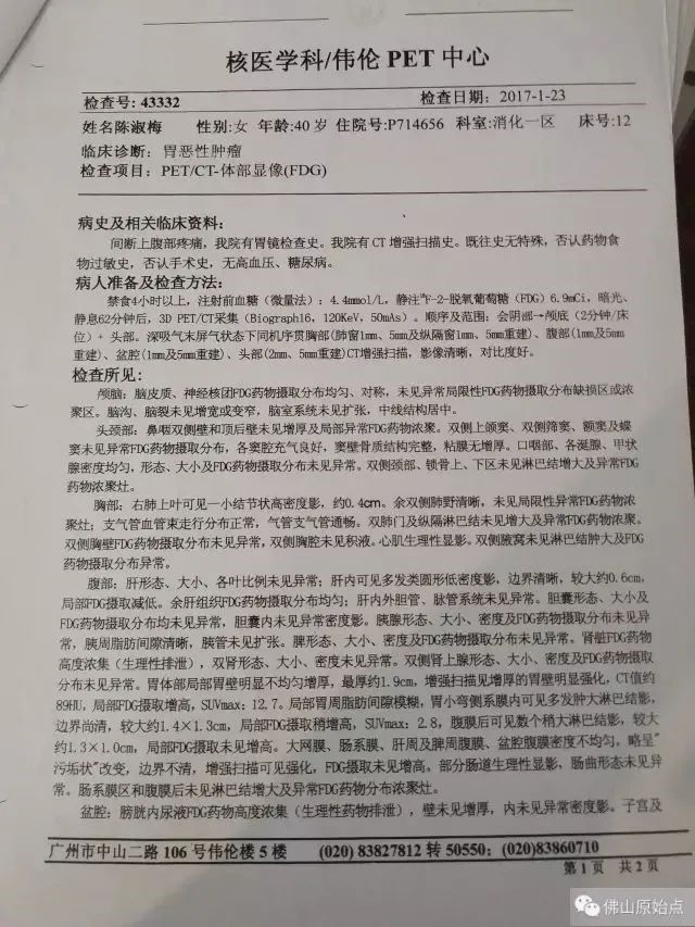 原始点调理胃癌:云淡风轻 原始点调理胃癌:云淡风轻