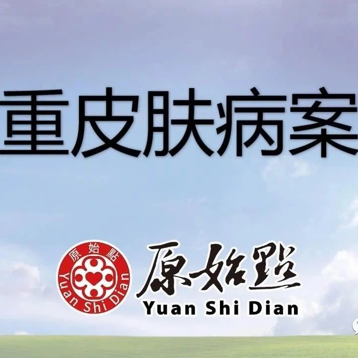 严重皮肤病案例2020年6月-原始点全球同学网