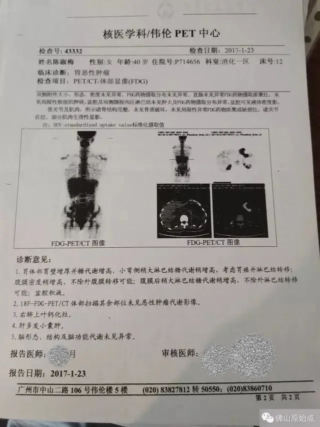 原始点调理胃癌:云淡风轻 原始点调理胃癌:云淡风轻