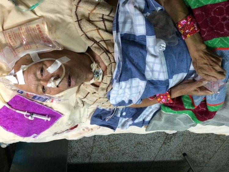 82岁老人车祸康复案例-硬膜撕裂伤、硬膜下水肿，双侧胸腔积液，坠积性肺炎，耻骨联合骨折，全身多处血肿、软组织损伤，低蛋白及贫血。