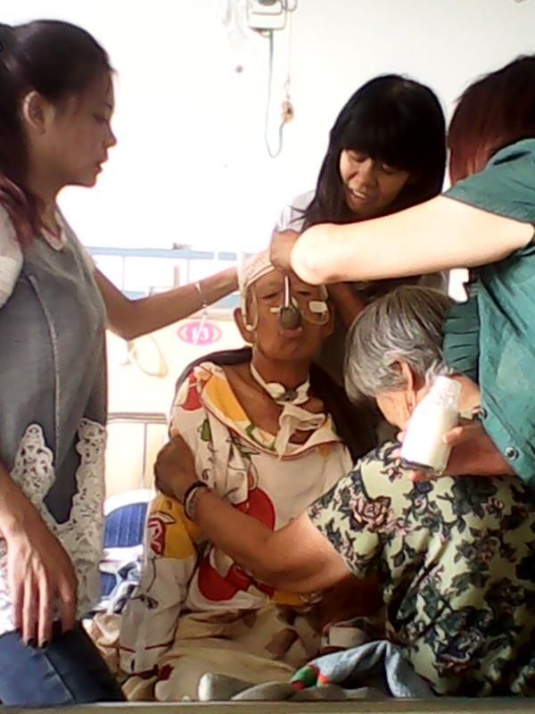 82岁老人车祸康复案例-硬膜撕裂伤、硬膜下水肿，双侧胸腔积液，坠积性肺炎，耻骨联合骨折，全身多处血肿、软组织损伤，低蛋白及贫血。