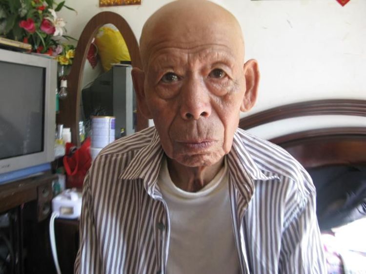 82岁老人车祸康复案例-硬膜撕裂伤、硬膜下水肿，双侧胸腔积液，坠积性肺炎，耻骨联合骨折，全身多处血肿、软组织损伤，低蛋白及贫血。