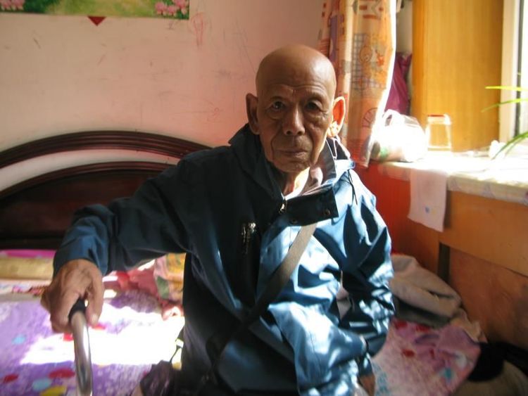 82岁老人车祸康复案例-硬膜撕裂伤、硬膜下水肿，双侧胸腔积液，坠积性肺炎，耻骨联合骨折，全身多处血肿、软组织损伤，低蛋白及贫血。